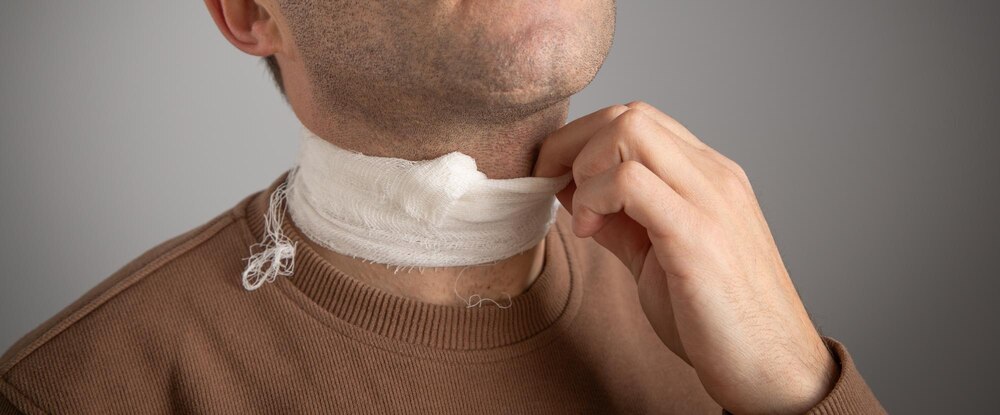 Revision Rhinoplasty Recovery Timeline 2025: What to Expect Month by Month After Secondary Nose Surgery