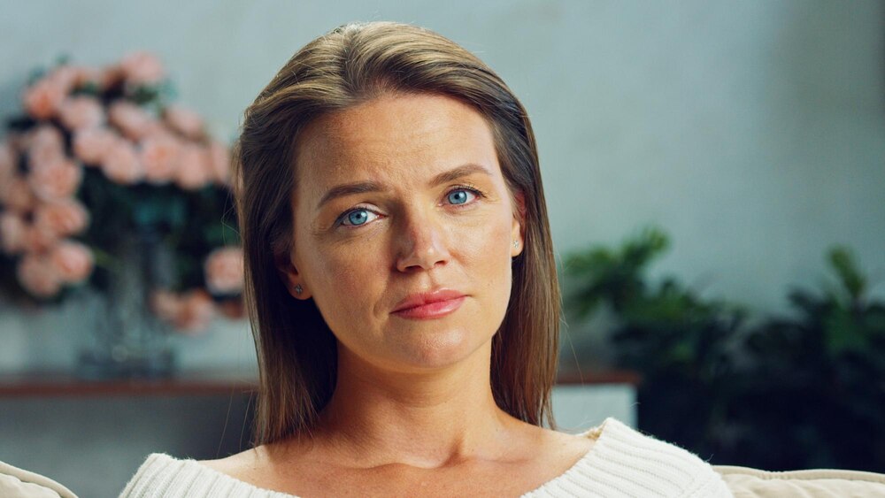 Endoscopic Brow Lift Results: Long-Term Outcomes and Patient Satisfaction Rates in 2025