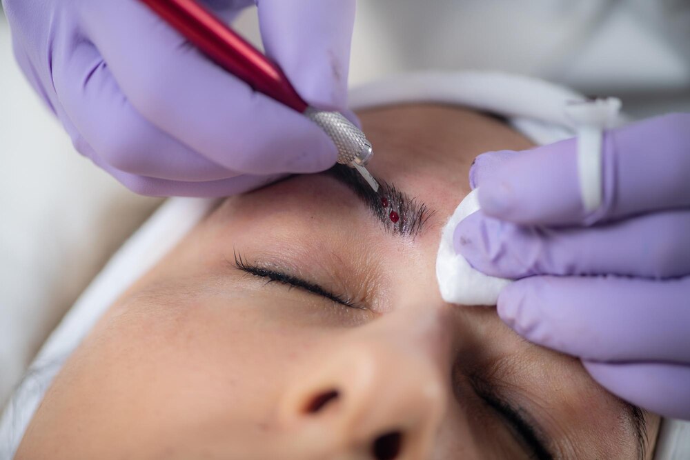 Cosmetic Eyebrow Surgery: Complete Guide to Transplants, Costs, and 2025 Trends
