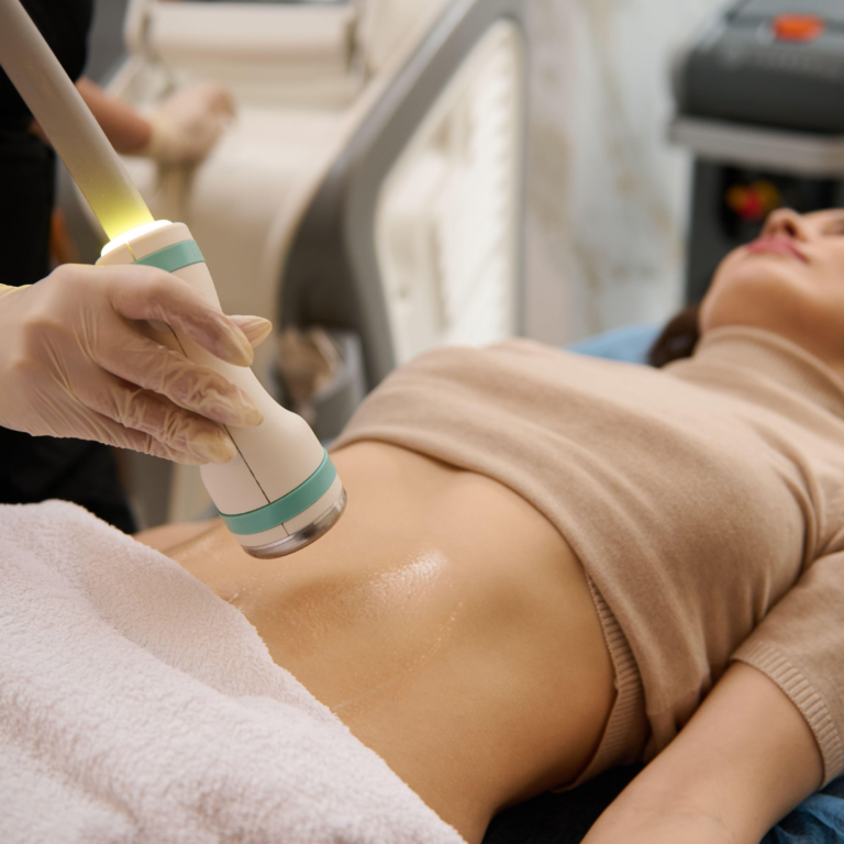 Skin Tightening after Weight Loss San Diego