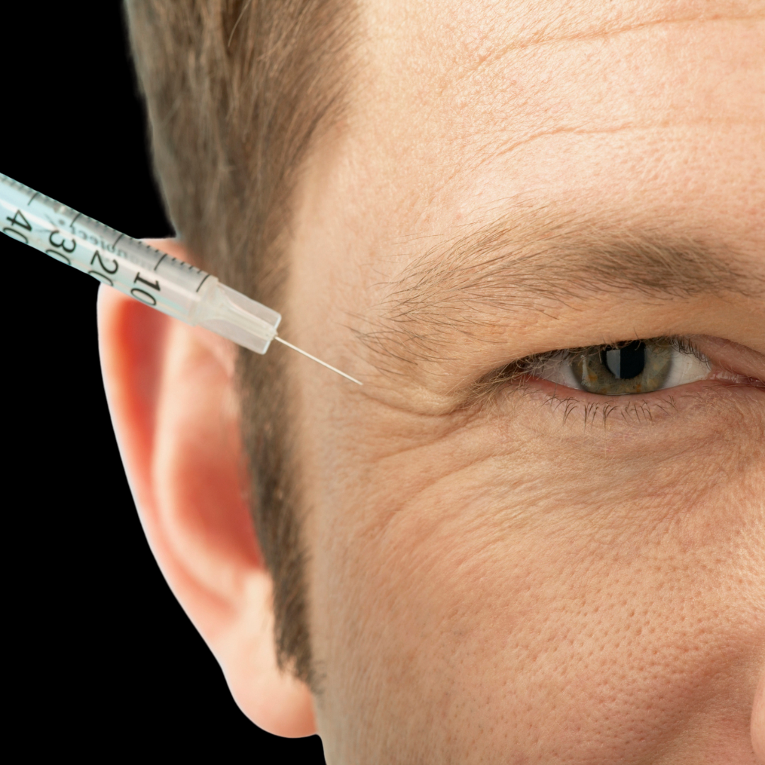 dr kashaf botox san diego california